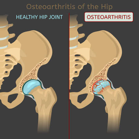 Key Principles of Postural Correction