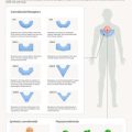 Comprehensive Guide to Arthritis-Friendly Exercise Regimens for British Adults