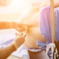 Addressing Lymphoedema in Cancer Rehabilitation: Strategies and Innovations