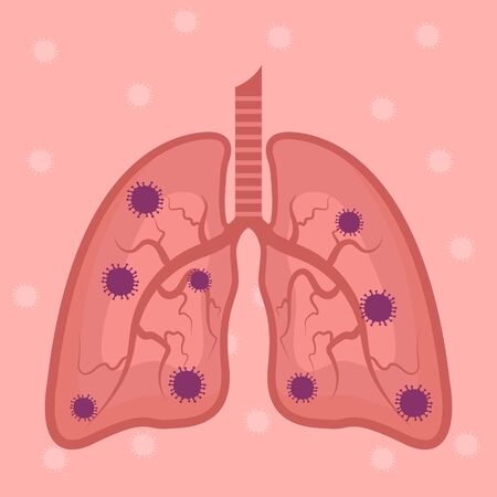 The NHS Approach to Pulmonary Rehabilitation: Funding, Delivery, and Access