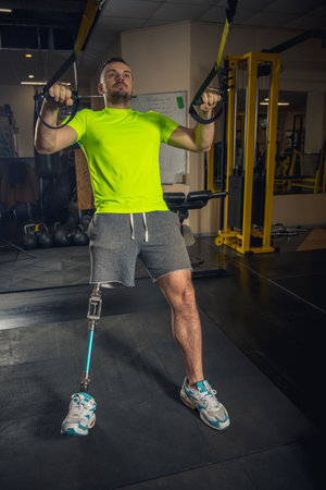 Understanding the Impact of Arthritis on Musculoskeletal Health in the UK