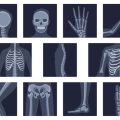 Understanding Common Sports Injuries in the UK: Causes, Prevention, and Recovery