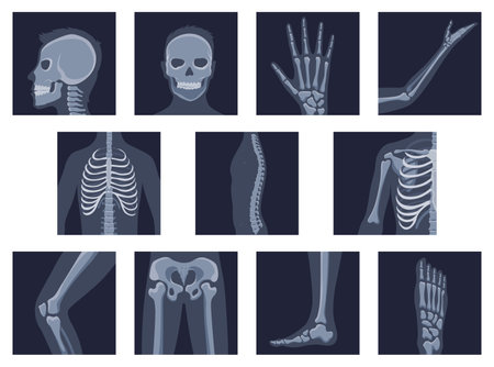 Understanding Common Sports Injuries in the UK: Causes, Prevention, and Recovery