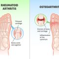 Bridging NHS Services and Private Rehabilitation for Arthritis Recovery in the UK