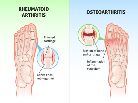 Bridging NHS Services and Private Rehabilitation for Arthritis Recovery in the UK