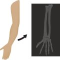 Understanding Fascia: Evidence-Based Approaches in Soft Tissue Mobilisation