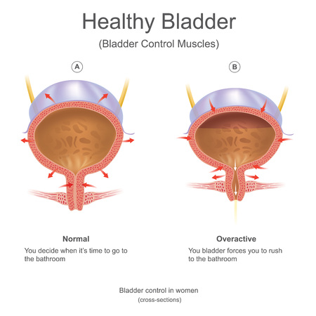 Frequent Injuries and Their Impact
