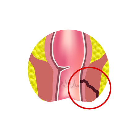 Principles of Soft Tissue Mobilisation