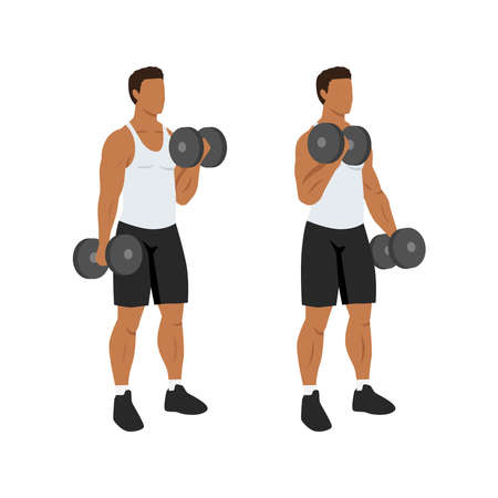 Principles of Exercise Prescription for Upper Limb Recovery